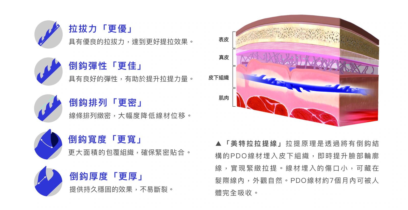 Meteora Thread美特拉埋線拉提療程補充圖 6